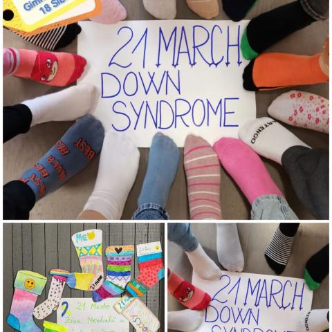 SYNDROME DOWN SYNDROME DOWN